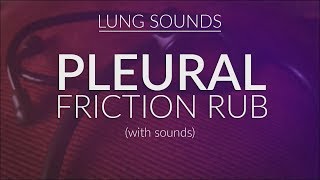 Pleural Friction Rub  Pleural Rub [upl. by Lydnek260]