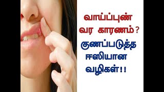 அடிநாக்கு சதையில் அழற்சி  டான்சில் நோய்  Tonsillitis  Immunity  Cure  DrYoga Vidhya [upl. by Temhem]