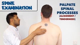 Spine Examination  OSCE Guide old version  UKMLA  CPSA [upl. by Lust]