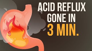 Reduce your Acid Reflux  Heartburn in just 3 Minutes 🔥 [upl. by Sarad]