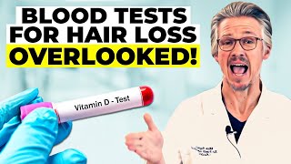 BLOOD TESTS FOR HAIR LOSS THE CRITICAL BLOOD TESTS YOU NEED NOW [upl. by Neenaj]