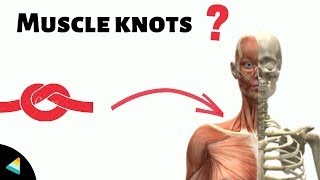 Muscle Knots Explained  Why do we get muscle knots [upl. by Nav]