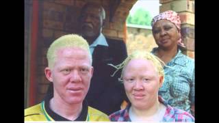 Albinism [upl. by Ettenom]