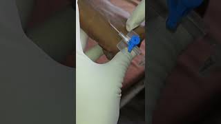 How to insert iv cannula in vein  cannulation technique medical hospital short [upl. by Nerrawed269]