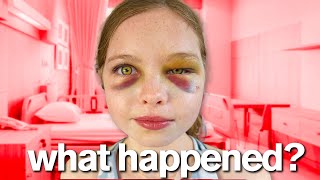 MY DAUGHTERS ACCIDENT [upl. by Nerol]