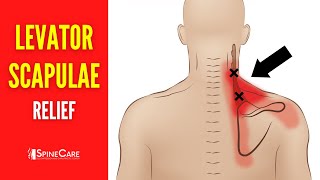 How to Fix Levator Scapulae Pain FOR GOOD [upl. by Nnyleitak]