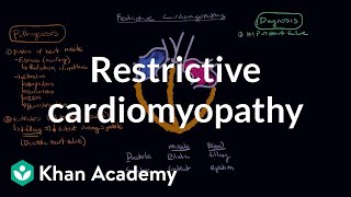 Restrictive cardiomyopathy Pathophysiology and diagnosis  NCLEXRN  Khan Academy [upl. by Zilvia]