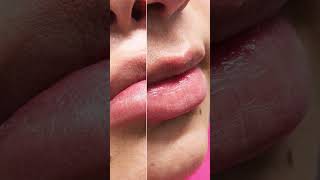 Lip Piercing Transformatie Piercings Works Amsterdam [upl. by Sakhuja]