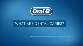 What are Dental Caries Treatments Signs and Symptoms  OralB [upl. by Thordis103]