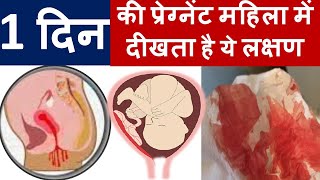 ये एक लक्षण प्रेग्नेंट एक दिन के प्रेग्नेंट महिला में दीखता है  Implantation bleeding in hindi [upl. by Tjon]