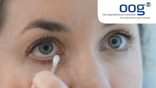 Reinigen en masseren van het ooglid bij blepharitis [upl. by Liban357]