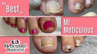 The Best of Mr Meticulous Pedicures ASMR [upl. by Cote42]