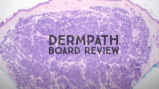 Dermatology amp Pathology Board Review Hyaluronic Acid Filler Trichoblastoma Blue Nevus amp more [upl. by Pietra420]