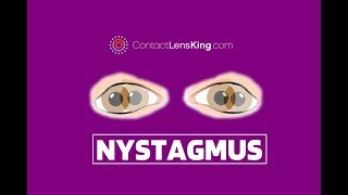 Nystagmus Eyes Explained  Involuntary Repetitive Eye Movement [upl. by Medovich]