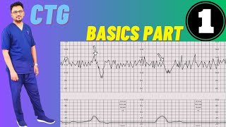 CTG Basics Part 1  CTG Monitoring in Pregnancy Fetal Cardiotocography [upl. by Medeah823]