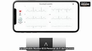 KardiaMobile Monitor ECG Personal de 6 derivaciones [upl. by Alane]