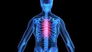 Thoracic Back Pain Explained by a Top Pain Physician in Las Vegas Nevada [upl. by Llednahs]