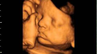 3d 4d ultrasound at 36 weeks GoldenView Ultrasound [upl. by Isidora]