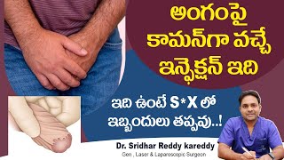 Common Foreskin Problems  Phimosis and Balanitis Treatment in Telugu  Treatment Range Hospital [upl. by Oiratno]