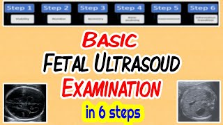 Basic Fetal Ultrasound Examination [upl. by Gemmell]