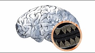 Inside the autism brain The cerebellum [upl. by Vinay]