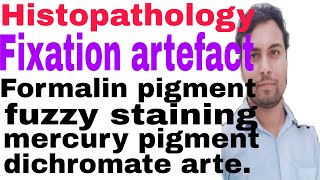 Fixation artefacts in histopathology  Troubleshooting  remedies in histological section  DMLT [upl. by Nanji]