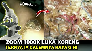 Percobaan kedua  Zoom 1000x Luka Koreng  dalemnya Meng3jutk4n [upl. by Phelips]