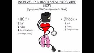 ICP and the ECG [upl. by Elson422]