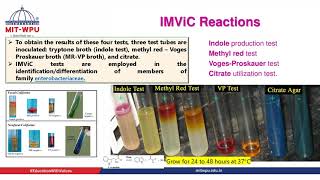 Understanding of Biochemical test IMViC [upl. by Sommer694]