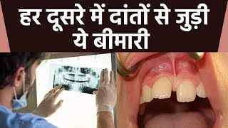 दांतों के बीच गैप Diastema बीमारी का कारण  दांतों के बीच गैप को कैसे ठीक करें  Boldsky [upl. by Lanaj]