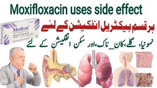 moxifloxacin 400 mg uses in urdu moxifloxacin 400 mg  Mofest 400mg  X gen 400mg  Avelox 400mg [upl. by Bucella]