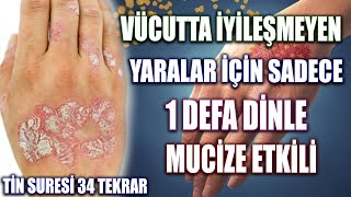 Vücutta iyileşmeyen yaralar için sadece 1 Defa Dinle  Hastaya okunacak dua Tin suresi fazileti [upl. by Fidelas]