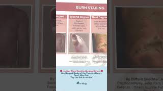 Understanding Burn Staging for Nursing Students 🌟 [upl. by Rosinski]