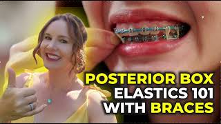 Posterior Box Elastics with Braces PBE [upl. by Danice]