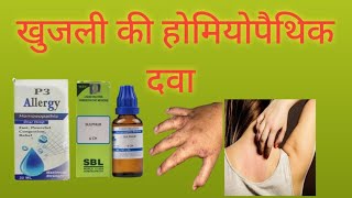 खुजली की होमियोपैथिक दवा homoeopathic medicine for scabies [upl. by Ariamoy]