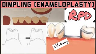 DIMPLING ENAMELOPLASTY II PROSTHETIC MOUTH PREPARATION II REMOVABLE PARTIAL DENTURE I PROSTHODONTICS [upl. by Yarahs280]