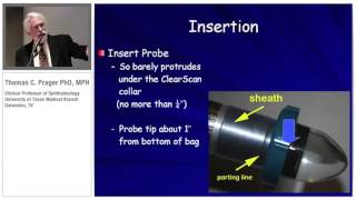 A new approach to Ultrasonic Biomicroscopy The Clearscan Methodology [upl. by Georgina]