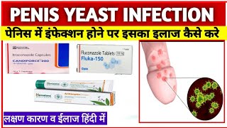 PENIS YEAST INFECTION TREATMENT इन्फेक्शन का संक्रमण होने के कारण लक्षण इलाज Hindi [upl. by Lawford]