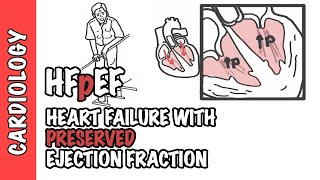 HFpEF  Heart Failure with Preserved Ejection Fraction [upl. by Merrile]