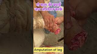 Amputation of leg l dr umar khan [upl. by Ennaid937]