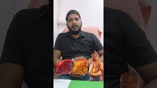 CHELIDONIUM MT Q ll LIVER संबंधित सभी समस्याओं को ठीक करे ll FATTY LIVER amp HEPATOMEGALY ll [upl. by Ayadahs]