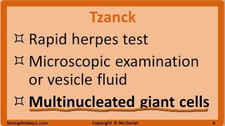 Herpes Mono HSV Chickenpox Shingles EBV CMV Cold Sore VZV Varicella [upl. by Mab]