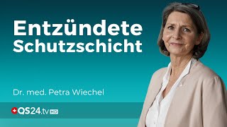 Schleimhautentzündungen  Ein Hinweis auf stille Entzündungen  Dr med Petra Wiechel  QS24 [upl. by Nogam]