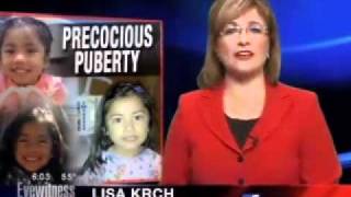 Precocious puberty [upl. by Nugent]