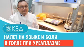 👅 Налет на языке и боли в горле при уреаплазме Клинический случай №451 [upl. by Blondy]