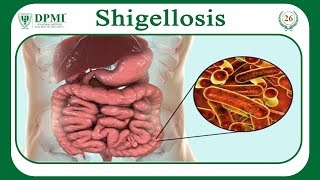 Shigellosis What Causes Shigellosis Shigella Morphology Classification Transmission amp Treatment [upl. by Nwahsel]