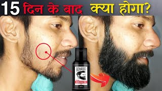 Beardo Hair Growth Oil After 15 Days Review  Best Beard Oil For Patchy Beard in India 2022 [upl. by Sedlik]