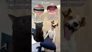 Team conventional braces or lingual braces bracesjourney braces dentalbraces orthodontics [upl. by Leuqcar]