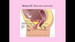 Stress Urinary Incontinence  CRASH Medical Review Series [upl. by Aretahs]