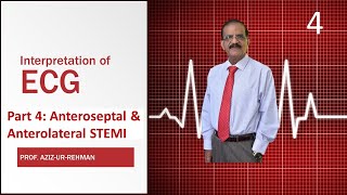 ECG Part 4 Anteroseptal amp Anterolateral STEMI final [upl. by Atarman743]